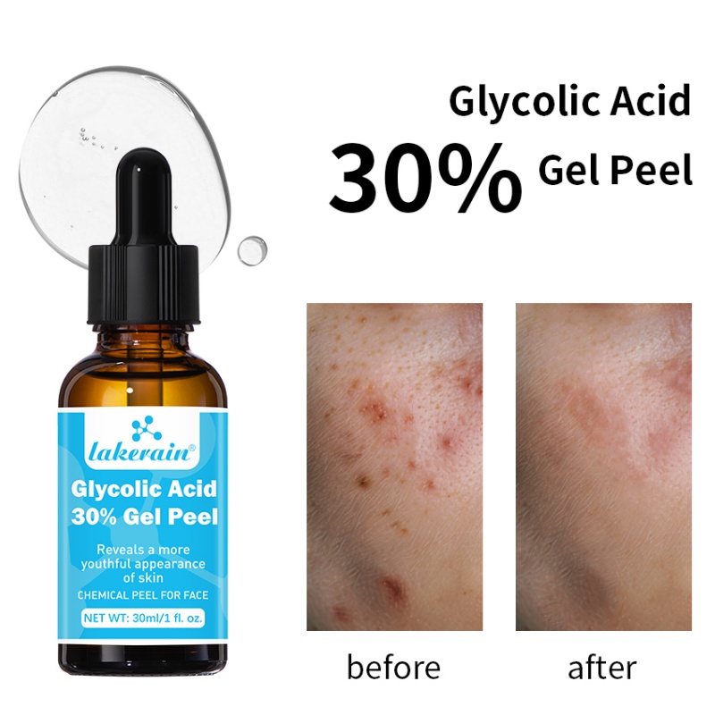 Lactic Acid Toner - 30% Glycolzuur Peel Gel Professionele Chemische