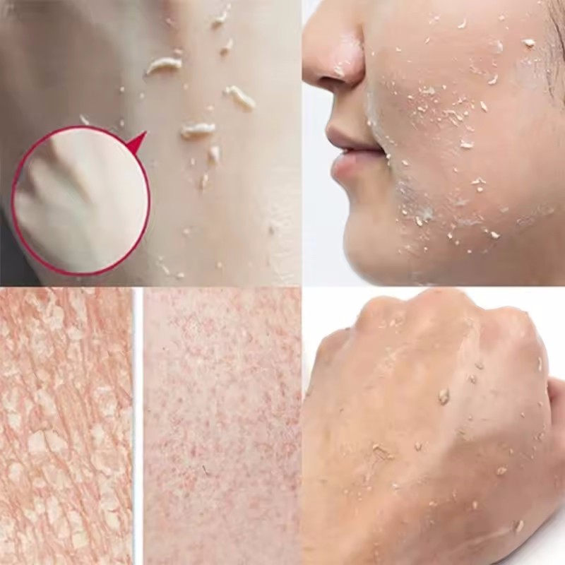Oranje Exfoliërende Peeling Ge - Ceramide Moisturizer recensie en prijs