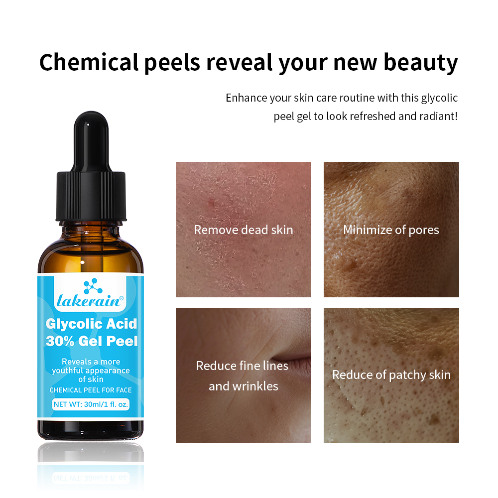 30% Glycolzuur Peeling Gel Pro - Lactic Acid Toner recensie en prijs